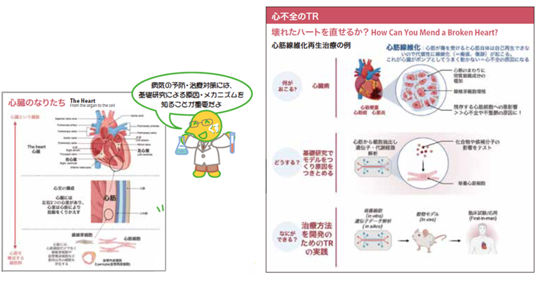 心臓のなりたちと心不全のTR