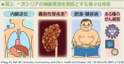 図2.一次シリアの機能異常を原因とするさまざまな疾患