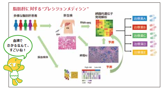 脂肪肝に対するプレシジョンメディシン