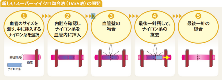 新しいスーパーマイクロ吻合法（IVaS法）の開発