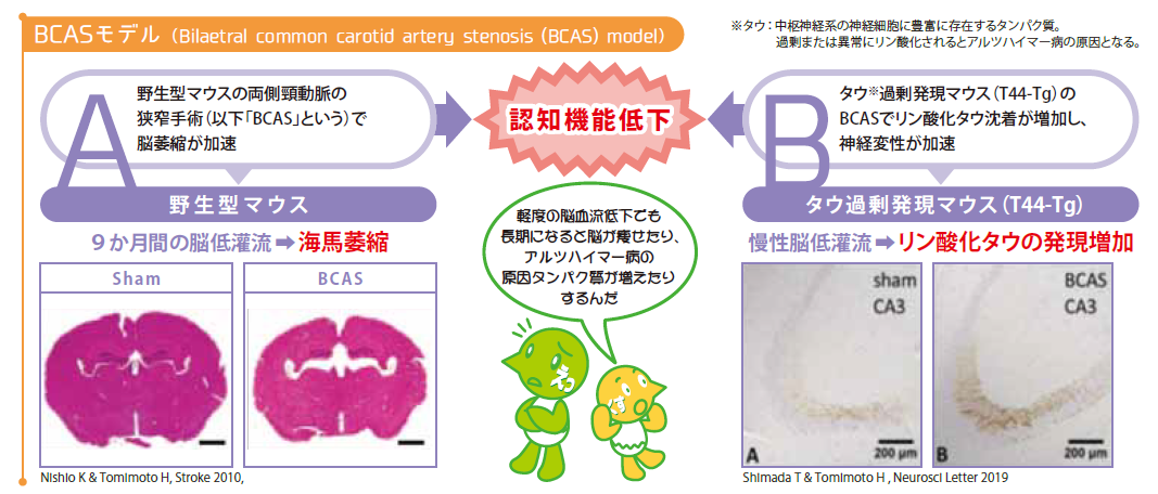 BCASモデル（Bilaetral common carotid artery stenosis (BCAS) model）