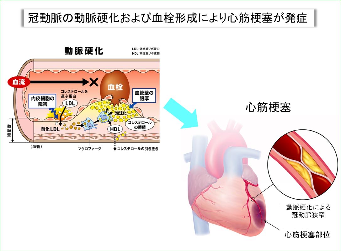 1心筋