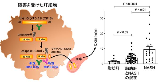 非アルコール性脂肪性肝炎のバイオマーカー確立　図