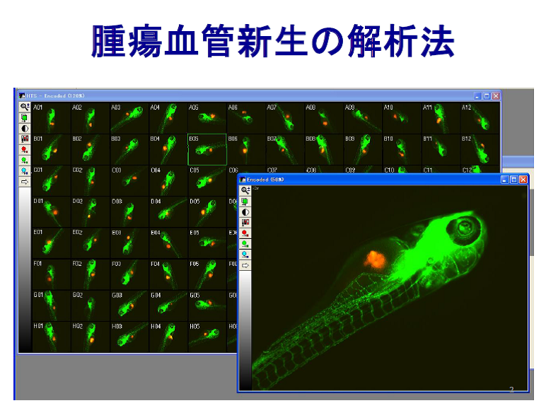 腫瘍血管新生の解析法