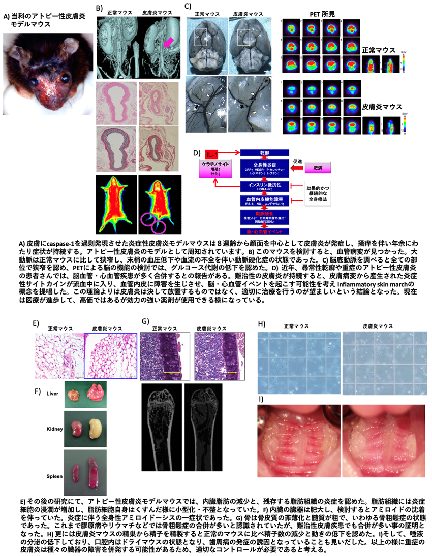 炎症性皮膚疾患リサーチセンター 概要図